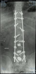 16.7.13 hinten-1024x2073.jpg