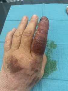 6A53762D-1DCC-4A22-8E1E-2DA1646A5F32.jpeg 6A53762D-1DCC-4A22-8E1E-2DA1646A5F32.jpeg